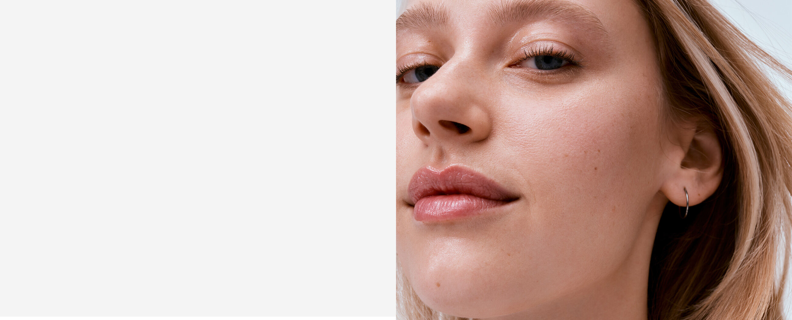 acne-prone